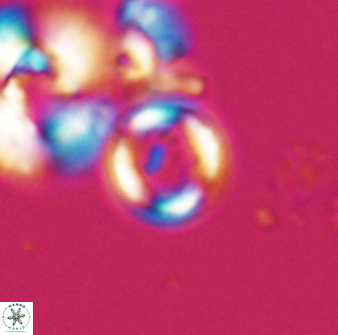 Denisea aliquanta 22310