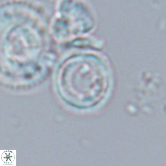 Denisea aliquanta 22311