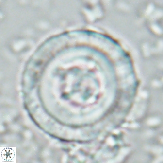 Denisea constricta 22030