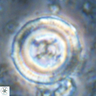 Denisea constricta 22031