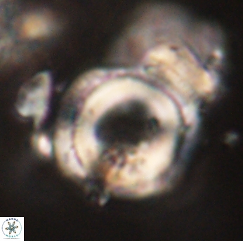 Denisea constricta 53171
