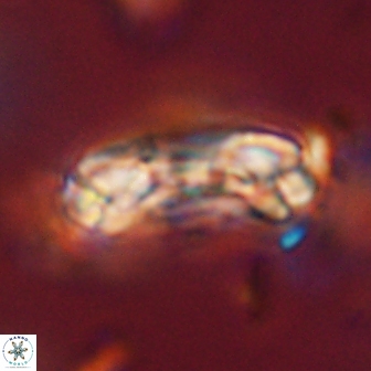 Denisea constricta 53209