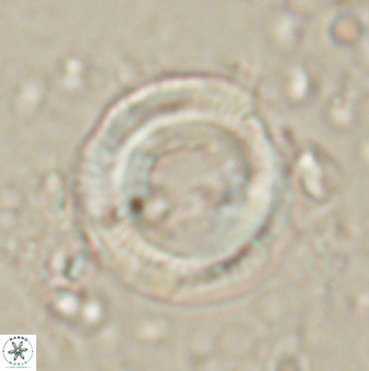 Denisea constricta 60936