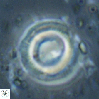 Denisea constricta 60937