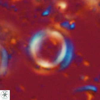 Denisea foramena 20915
