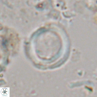 Denisea foramena 20916