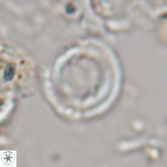 Denisea foramena 20917