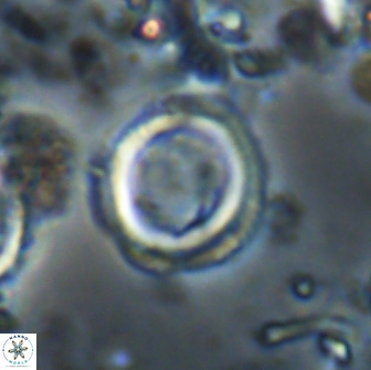 Denisea foramena 20918