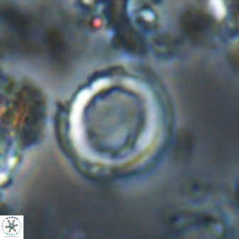 Denisea foramena 20919