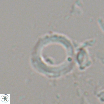 Denisea foramena 21057