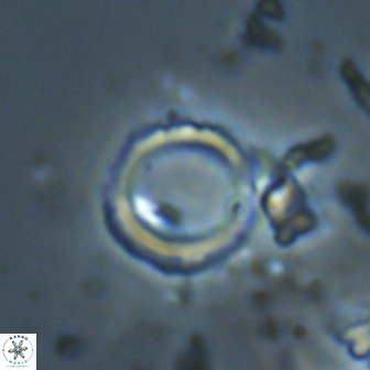 Denisea foramena 21059