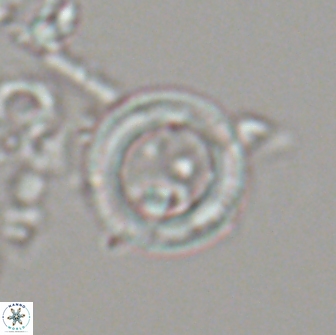 Denisea foramena 21575