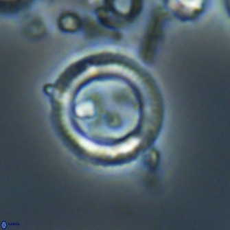 Denisea foramena 21578