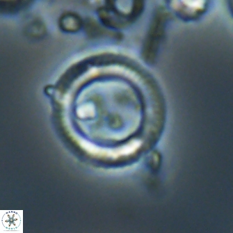 Denisea foramena 21578
