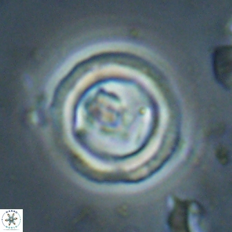 Denisea foramena 59961