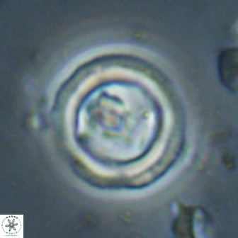 Denisea foramena 59962