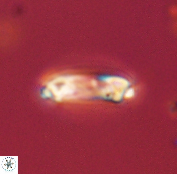 Denisea foramena 52838