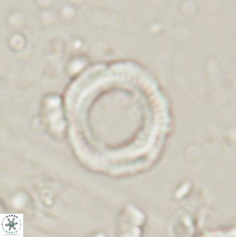 Denisea foramena 53607