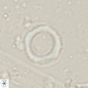 Denisea foramena 53608