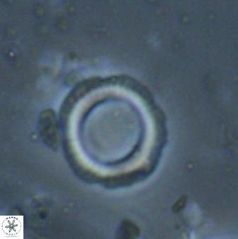 Denisea foramena 53609