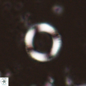 Denisea foramena 53602
