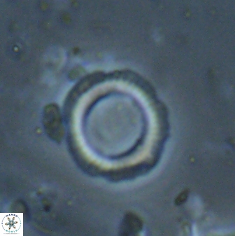 Denisea foramena 53610