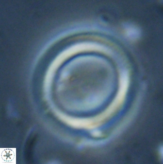 Denisea polymegalo 23422