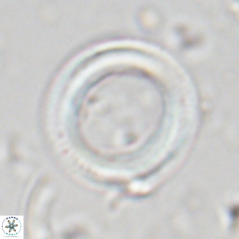 Denisea polymegalo 23423