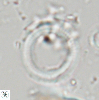 Denisea polymegalo 23384