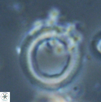 Denisea polymegalo 23386