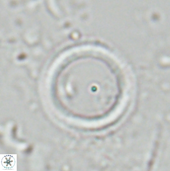 Denisea polymegalo 25190