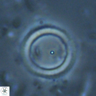 Denisea polymegalo 25191