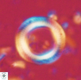Denisea polymegalo 59853