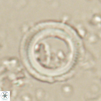 Denisea polymegalo 59858