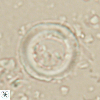 Denisea polymegalo 59859