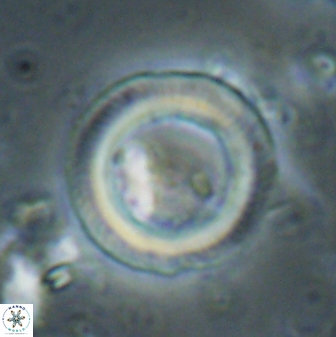 Denisea polymegalo 59860