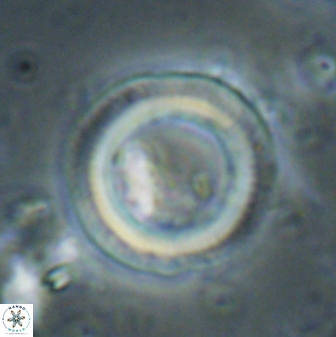 Denisea polymegalo 59861