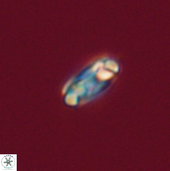Denisea subpertusa 20756
