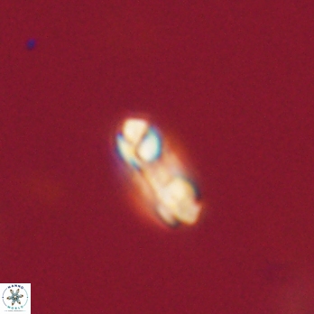 Denisea subpertusa 20770