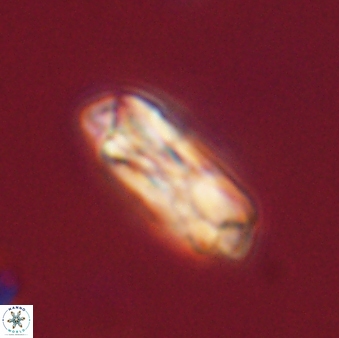 Denisea subpertusa 52967