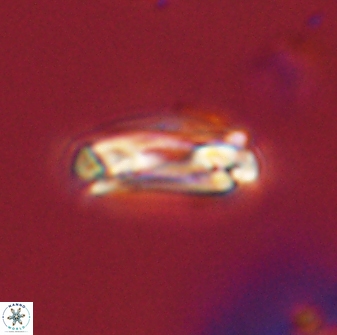 Denisea subpertusa 58322