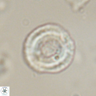 Denisea subpertusa 58332