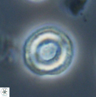 Denisea subpertusa 58337