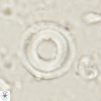 Denisea subpertusa 60970