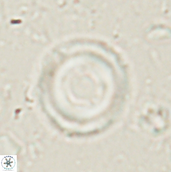 Denisea subpertusa 60971