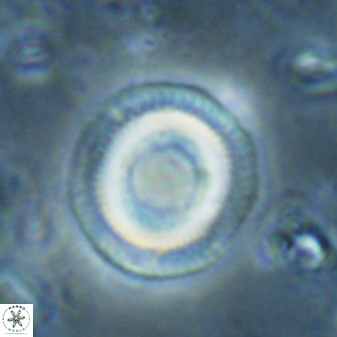 Denisea subpertusa 60972
