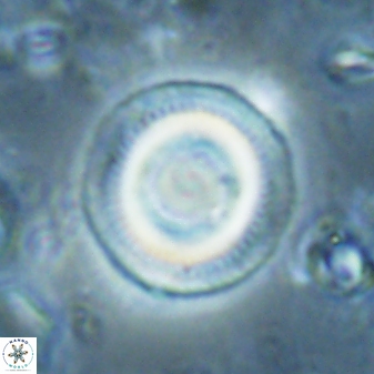 Denisea subpertusa 60974
