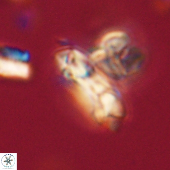 Denisea subpertusa 63990