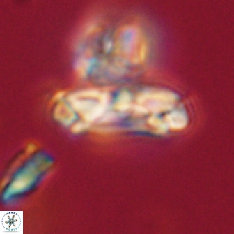 Denisea subpertusa 63993