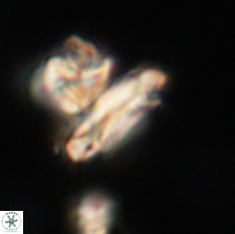 Denisea subpertusa 63995